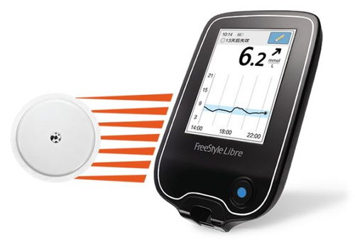 陳根 唾液測(cè)血糖,更便攜更高效